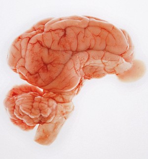 Cérebro de porco