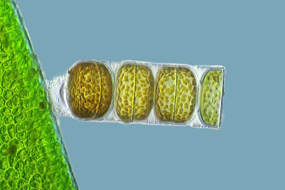 Alga melosira