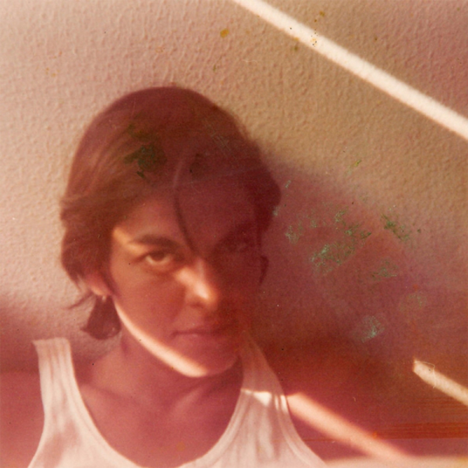 Joana em 1976, um ano antes da cirurgia