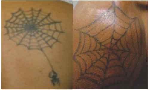 Teia de aranha: Portadores dessa tattoo costumam agir em grupo. Significado pode variar de acordo com a posição da aranha.