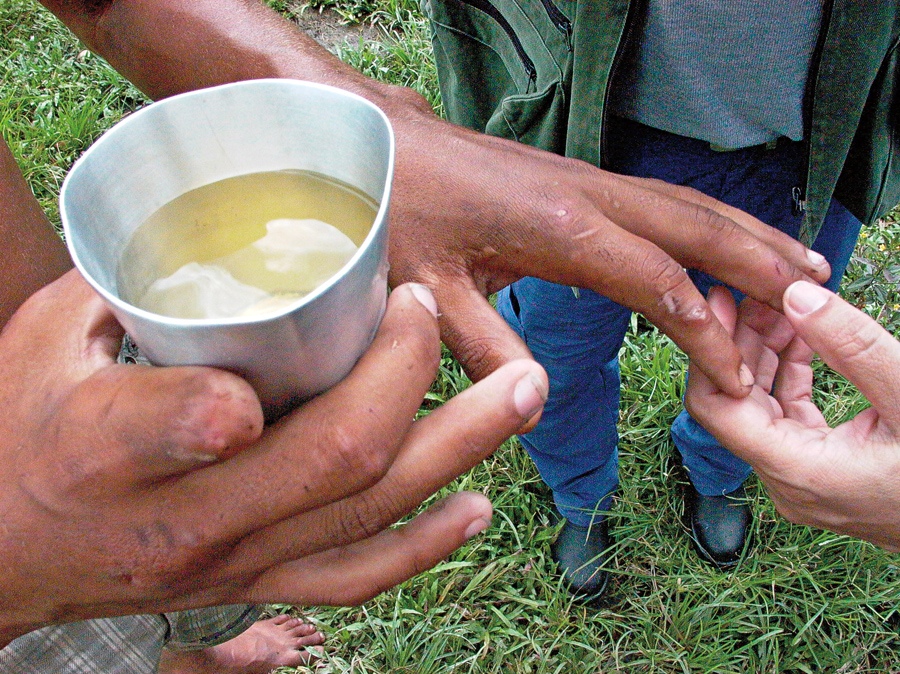 Cenas do Pará: mão de escravo que aplicava veneno sem proteção (a água marrom era a que ele tinha para beber e o dedo foi mutilado no trabalho)