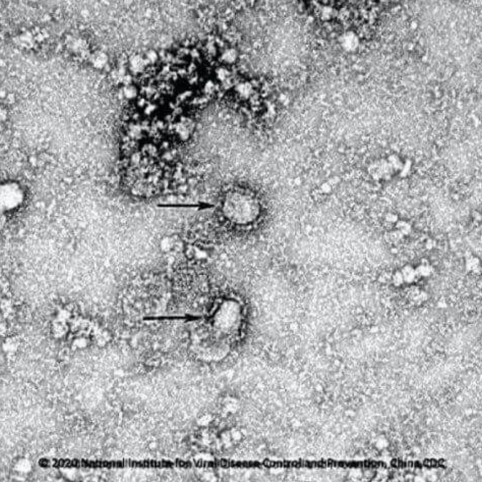 O coronavírus, uma ameaça tão agressiva, mas só visível em um microscópio