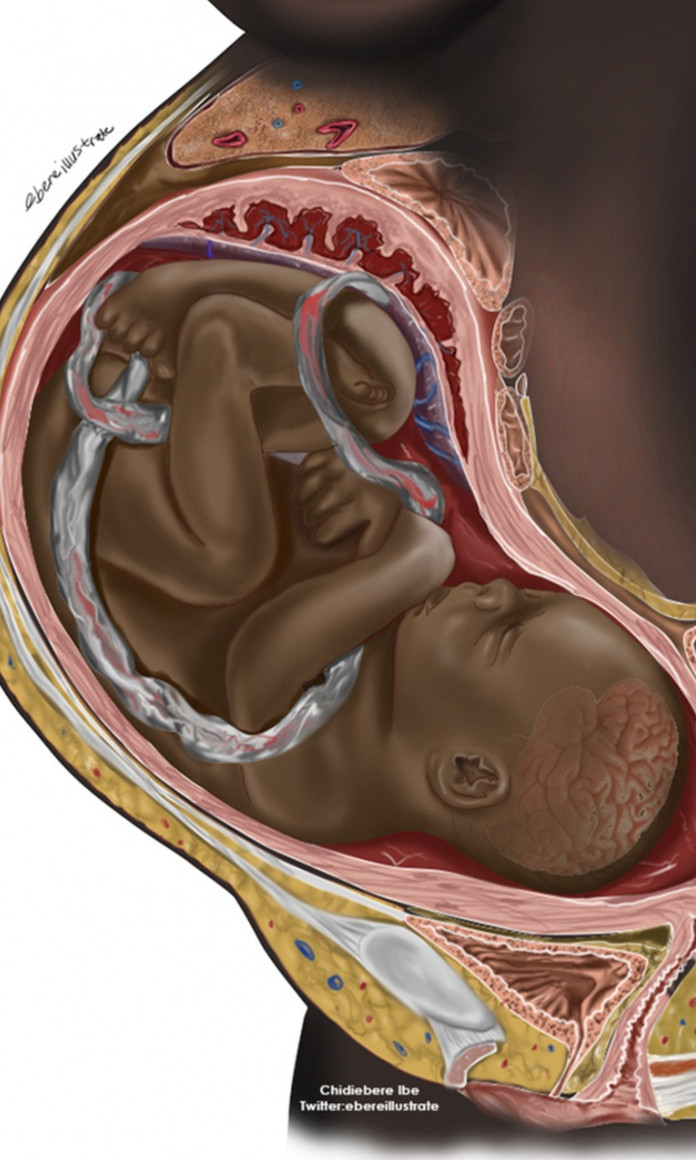 Ilustração de um bebe negro na barriga da mãe