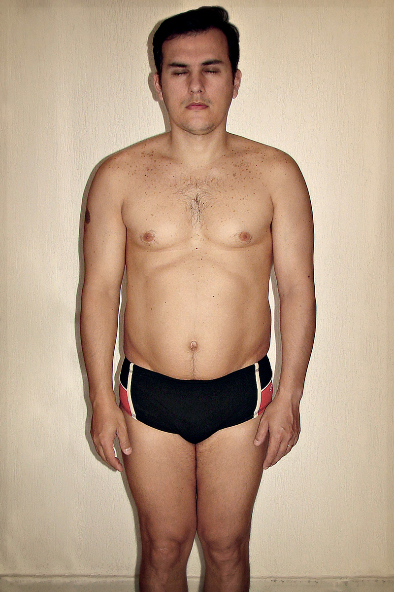 Depois (+15 kg)