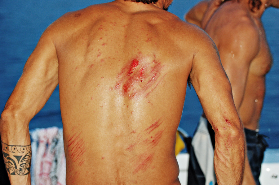 Com poucos imprevistos, como o arranhão de Armandinho, a maior parte do tempo foi só alegria