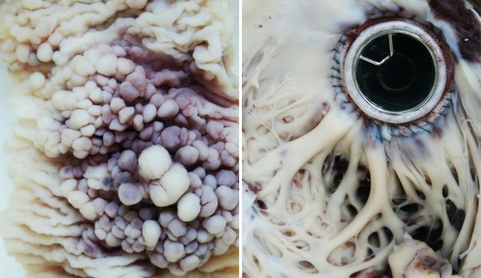 A morte pode ser bonita