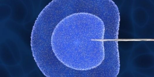 Pelo direito de ter filhos!