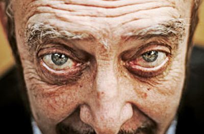 Conservado em álcool