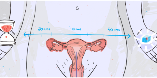 Por que mesmo devo congelar meus óvulos?